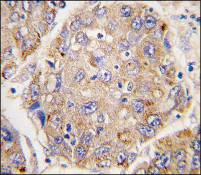 Anti-LECT2 (N-term) antibody produced in rabbit affinity isolated antibody, buffered aqueous solution