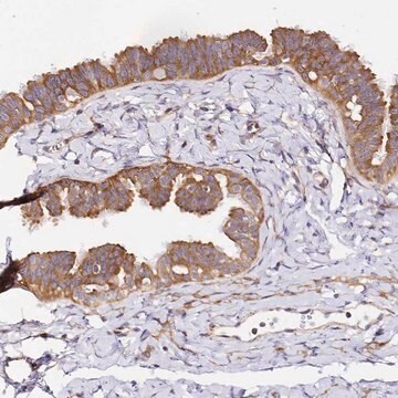 Anti-RPL13A antibody produced in rabbit Prestige Antibodies&#174; Powered by Atlas Antibodies, affinity isolated antibody, buffered aqueous glycerol solution