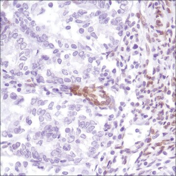 Anti-FBXW7 antibody, Rabbit monoclonal recombinant, expressed in proprietary host, clone SP237, affinity isolated antibody