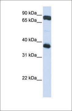 Anti-GP6 antibody produced in rabbit affinity isolated antibody