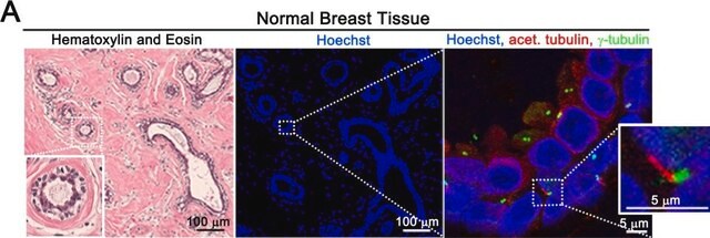 抗&#947;チューブリン抗体、マウスモノクローナル マウス宿主抗体 clone GTU-88, purified from hybridoma cell culture