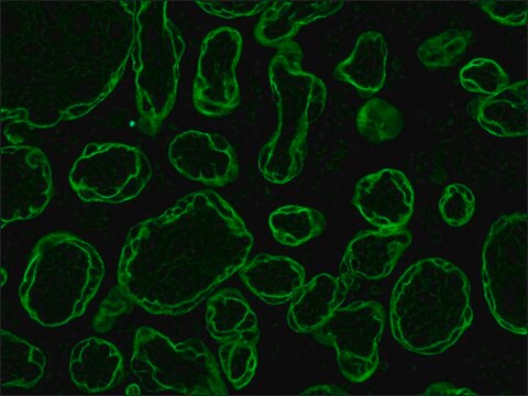 Monoclonal Anti-Cytokeratin, pan antibody produced in mouse clone C-11, ascites fluid