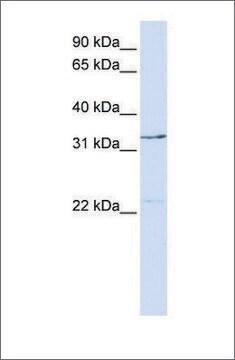 Anti-GTF2E2 antibody produced in rabbit affinity isolated antibody