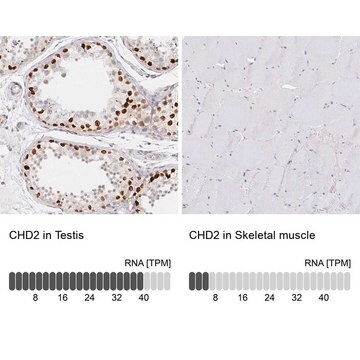 Anti-CHD2 antibody produced in rabbit Prestige Antibodies&#174; Powered by Atlas Antibodies, affinity isolated antibody, buffered aqueous glycerol solution