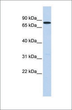 Anti-DDX41 antibody produced in rabbit affinity isolated antibody