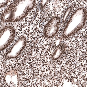 Anti-SETD2 antibody produced in rabbit Prestige Antibodies&#174; Powered by Atlas Antibodies, affinity isolated antibody, buffered aqueous glycerol solution