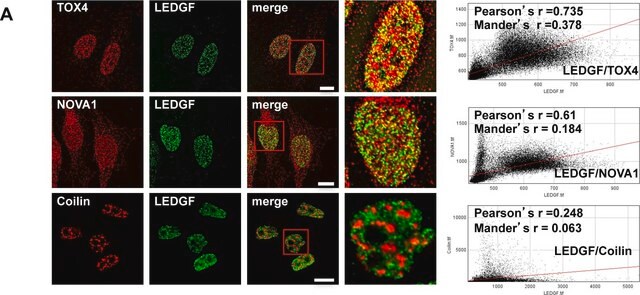 Anti-TOX4 antibody produced in rabbit affinity isolated antibody, buffered aqueous glycerol solution