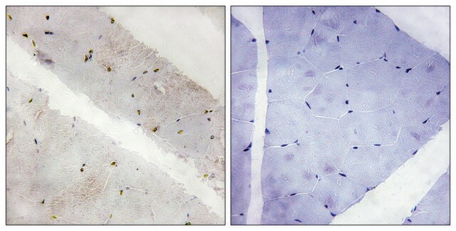 Anti-LATS2 antibody produced in rabbit affinity isolated antibody