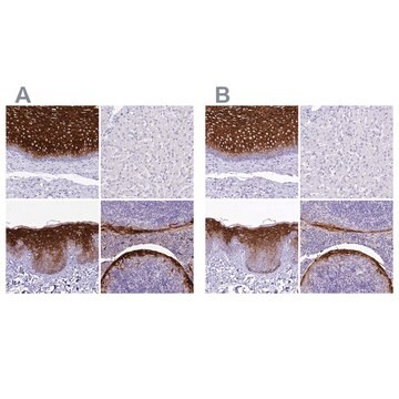 Anti-A2ML1 antibody produced in rabbit Prestige Antibodies&#174; Powered by Atlas Antibodies, affinity isolated antibody, buffered aqueous glycerol solution