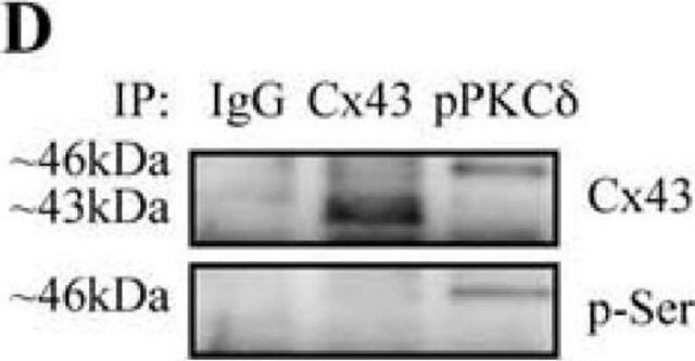 Monoclonal Anti-Phosphoserine antibody produced in mouse clone PSR-45, purified immunoglobulin, buffered aqueous solution