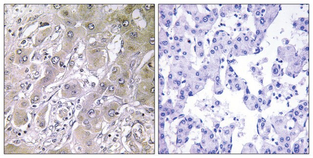 Anti-ACOT12 antibody produced in rabbit affinity isolated antibody