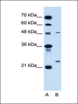 Anti-SMPD2 antibody produced in rabbit IgG fraction of antiserum