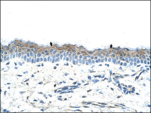 Anti-SerPINB5 antibody produced in rabbit IgG fraction of antiserum