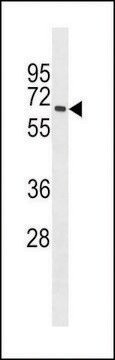 ANTI-MBOAT7 (CENTER) antibody produced in rabbit affinity isolated antibody, buffered aqueous solution