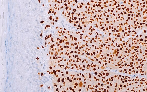 PRAME (EP461) Rabbit Monoclonal Primary Antibody