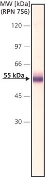 Anti-Factor IX antibody, Mouse monoclonal clone HIX-5, purified from hybridoma cell culture