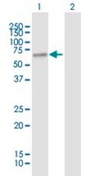 Anti-SLC27A1 antibody produced in mouse purified immunoglobulin, buffered aqueous solution