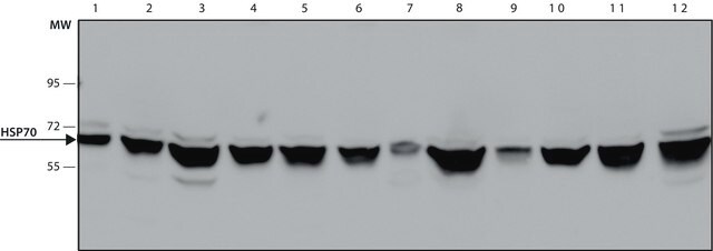 Anti-Heat Shock Protein 70 (HSP70) antibody, Mouse monoclonal clone BRM-22, purified from hybridoma cell culture