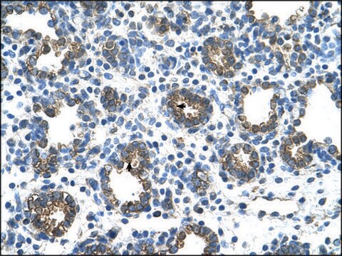 Anti-GUSB antibody produced in rabbit IgG fraction of antiserum