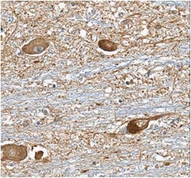 Anti-Versican Antibody, clone 8D8.1 clone 8D8.1, from mouse