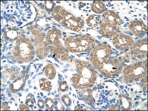 Anti-ALAS2 antibody produced in rabbit IgG fraction of antiserum