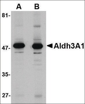 Anti-ALDH3A1 antibody produced in rabbit affinity isolated antibody, buffered aqueous solution