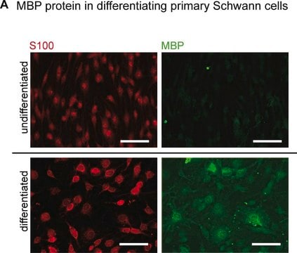 Anti-S-100 Protein Antibody, clone 15E2E2 clone 15E2E2, Chemicon&#174;, from mouse