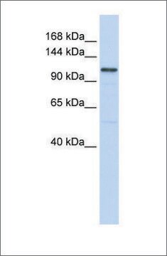 Anti-ADCY8 antibody produced in rabbit affinity isolated antibody