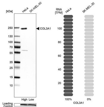 抗COL3A1抗体 ウサギ宿主抗体 Prestige Antibodies&#174; Powered by Atlas Antibodies, affinity isolated antibody, buffered aqueous glycerol solution