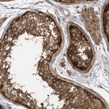 Anti-REPS1 antibody produced in rabbit Prestige Antibodies&#174; Powered by Atlas Antibodies, affinity isolated antibody, buffered aqueous glycerol solution