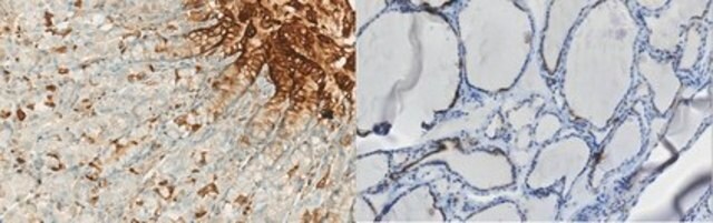 Anti-Sodium-Iodide Symporter Antibody, C-terminal 2 from rabbit