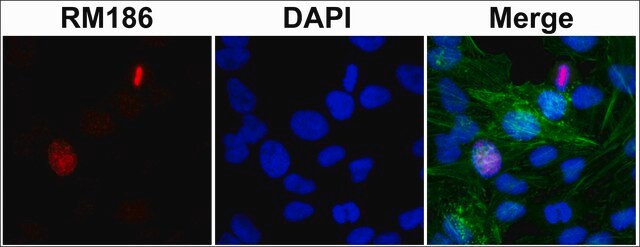 Anti-Histone H3 (unmodified Lys4) antibody, Rabbit monoclonal recombinant, expressed in HEK 293 cells, clone RM186, purified immunoglobulin