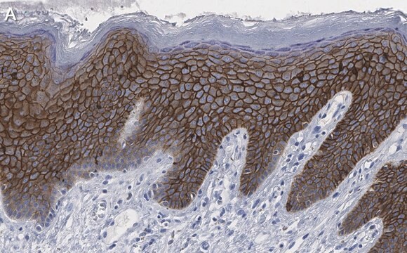 Anti-Claudin-1 Antibody, clone 1O12 ZooMAb&#174; Rabbit Monoclonal recombinant, expressed in HEK 293 cells