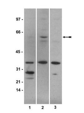 Anti-phospho-Smad1 (Ser463/465) Antibody Upstate&#174;, from rabbit