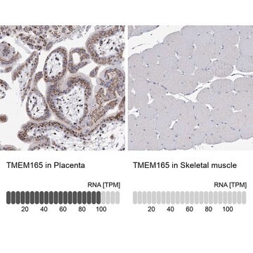 Anti-TMEM165 antibody produced in rabbit Prestige Antibodies&#174; Powered by Atlas Antibodies, affinity isolated antibody, buffered aqueous glycerol solution