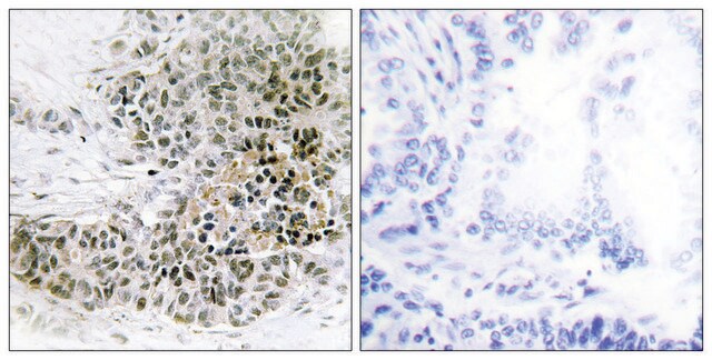 Anti-TRPS1 antibody produced in rabbit affinity isolated antibody