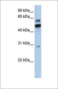 Anti-ESRRA antibody produced in rabbit affinity isolated antibody