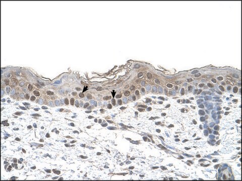 Anti-ARRB2 antibody produced in rabbit affinity isolated antibody