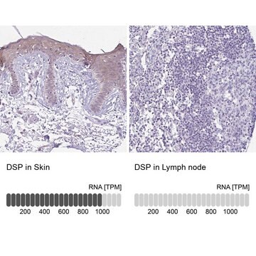 Anti-DSP antibody produced in rabbit Prestige Antibodies&#174; Powered by Atlas Antibodies, affinity isolated antibody, buffered aqueous glycerol solution