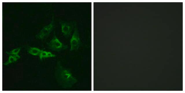 Anti-GNRHR antibody produced in rabbit affinity isolated antibody