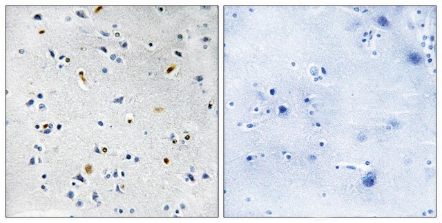 Anti-DIL-2 antibody produced in rabbit affinity isolated antibody