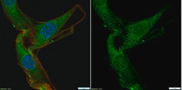 Anti-Partitioning-defective 3 Antibody Upstate&#174;, from rabbit