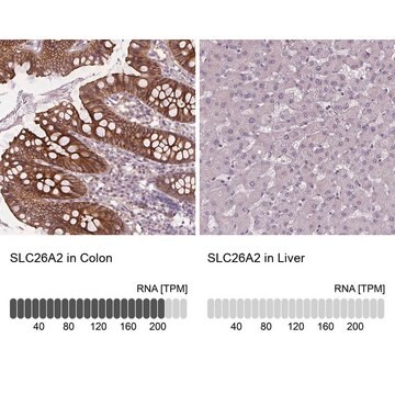 Anti-SLC26A2 antibody produced in rabbit Prestige Antibodies&#174; Powered by Atlas Antibodies, affinity isolated antibody, buffered aqueous glycerol solution