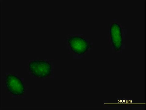 Anti-UBE2V1 antibody produced in mouse IgG fraction of antiserum, buffered aqueous solution