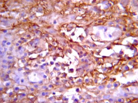 Anti-Notch 1 Antibody, NT serum, from rabbit