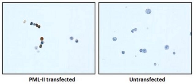 Anti-PML Isoform II Antibody, clone 1A8.1 clone 1A8.1, from mouse