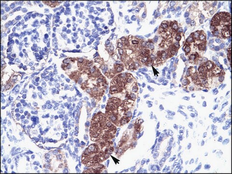 Anti-SOX18 affinity isolated antibody