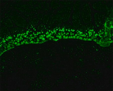 Monoclonal Anti-S100A6 antibody produced in mouse clone CACY-100, ascites fluid