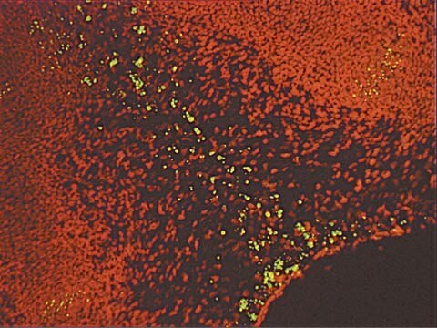 ApopTag Fluorescein In Situ Apoptosis Detection Kit The ApopTag Fluorescein In Situ Apoptosis Detection Kit detects apoptotic cells in situ by the indirect TUNEL method, utilizing an anti-digoxigenin antibody that is conjugated to a Fluorescein reporter molecule.