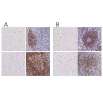 Anti-CD37 antibody produced in rabbit Prestige Antibodies&#174; Powered by Atlas Antibodies, affinity isolated antibody, buffered aqueous glycerol solution